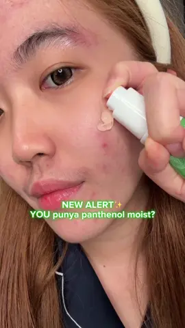 WAJIB PUNYA! Moisturizer yang bikin jerawat mereda & calming banget 😍✨ Coba deh YOU ini ada kandungan panthenol nya! #jeratjerawat 