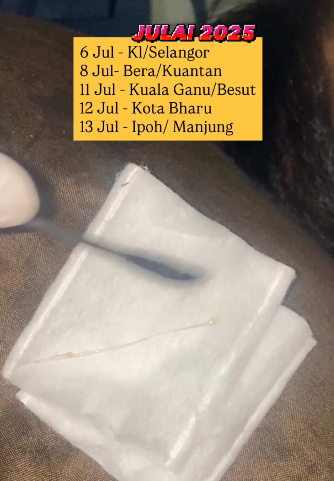 Calling for Pantai Timur!  #juling #buta #silau #rabun #perak #katarak #rawatanmata #ganu #pterygium #ganu #bera #matakabur #alternatiftreatment #rawatanmatapuchong 