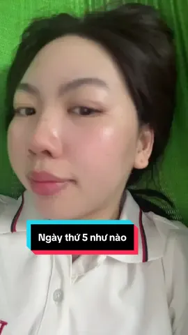 Cũng đang hoang mang quá #fypシ #xuhuong #chamsocda #goclamdep #skincare 