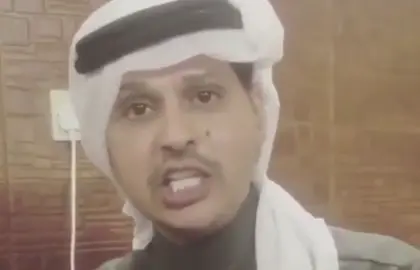 #جراح_الهبيده #رياكشنات #غدو#fyppppppppppppppppppppppp 