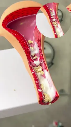 #drwawanawake #lighterherbalclinic ##loveyou #uchafu #fungusi #pid #uti #PREGNANT #fertility #tanzania #uganda #Tanzania #fertilityjourney 