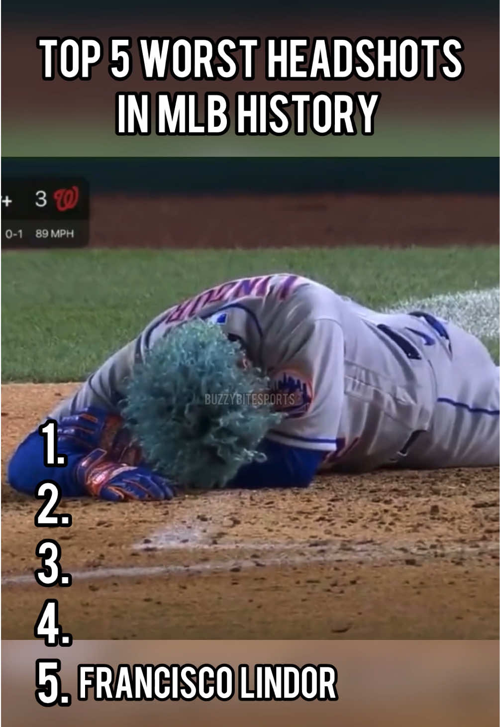 Top 5 WORST HEADSHOTS in MLB history! #baseball #MLB #fyp #foryou #foryoupage #viral 