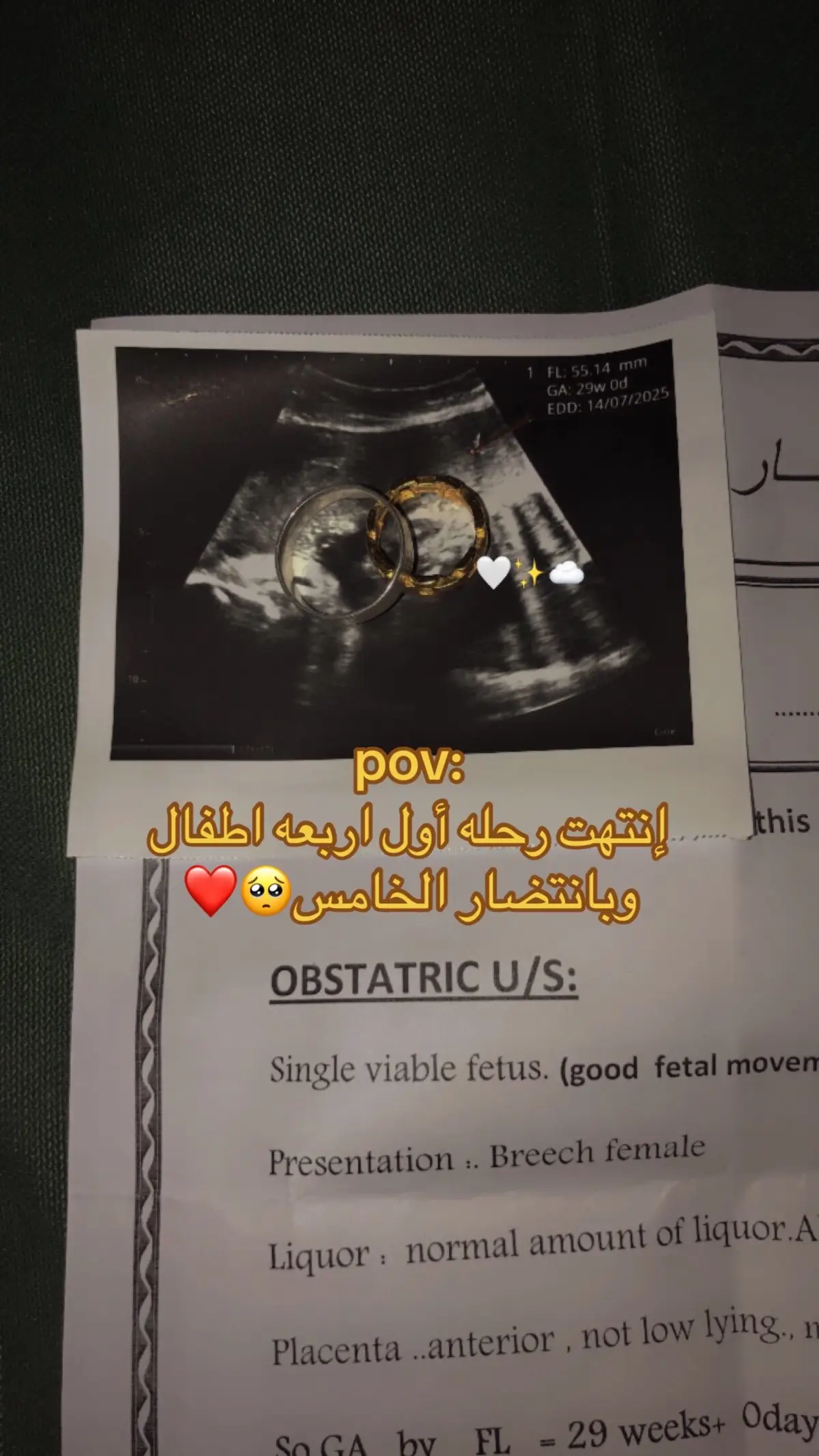 الحمدلله 🥹💔#ربي_يرزق_كل_ماعندة_ذرية 