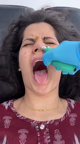 🎯 Liberação Facial Cranial (CFR): Terapia ou mito? ⠀ 💭 Já ouviu falar de uma técnica que “realinha” ossos do crânio com balões infláveis inseridos pelo nariz? Parece coisa de ficção… mas é real e chamada Cranial Facial Release (CFR). ⠀ 🔬 Mas o que a ciência diz? ▪️ A técnica afirma desbloquear vias aéreas, aliviar dores de cabeça, sinusites, e até melhorar performance cognitiva. ▪️ No entanto, nenhum estudo clínico robusto comprovou sua eficácia — até hoje, os relatos positivos são anecdóticos ou atribuíveis ao efeito placebo (Ernst, 2012). ▪️ Especialistas apontam que os ossos do crânio adulto não se movem da forma que a CFR propõe, tornando o mecanismo teórico anatomicamente improvável (Cerritelli et al., 2024). ⠀ ⚠️ Riscos? Sim. Por envolver estruturas delicadas (como as fossas nasais e tubos auditivos), podem ocorrer lesões, dor, ou infecção, especialmente sem supervisão médica adequada. ⠀ 📚 Sociedades médicas e fisioterapêuticas na Europa e EUA não reconhecem CFR como terapia baseada em evidência. ⠀ 💡 Conclusão clara: Não existem provas de que CFR trate doenças de forma segura ou eficaz. Se busca alívio para sinusites, DTM ou enxaqueca, consulte profissionais da medicina ou fisioterapia com abordagem científica. ⠀ 🔎 Cuidado com modismos que usam linguagem médica, mas carecem de ciência. ⠀ 📌 Salve para se proteger de terapias sem comprovação. #CFR #MedicinaBaseadaEmEvidencias #CranialRelease #SaúdeComCiência #Fisioterapia #DTM #Sinusite