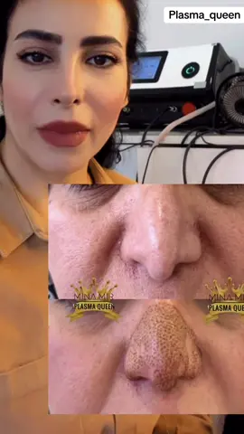 سلاو ريز  هولیر بختیاری کولانی ته نیشت درگای گه را جی گولان مول ،  برامبر  Swiss market   قاطی سه ر مطعم سوار   بینایی Nrgez Plaza  قاطی دو ٠٧٥١٥١٧٢٨٦٩ اربيل شارع گولان مقابل گولان تاور الطابق الثانی فوق مطعم سوار مقابل مکتب فیزا الترکیه  07515172869 . . #foryou #duhok_zaxo_amedi_semel_akre #karkuk_hawler_mosul_slemane️ #erbil_iraq #slimani #slimani_سليماني #slimaniyakm🖤❤️ #سلیمانی #سلیمانیه_کةرکوک_اربیل_کردستان_عراق #shaqlawa #بارزان #masifpirmam #hawler #erbil_city #پلاسماکویین #سوران_اربيل #karkuk_کەرکوک 