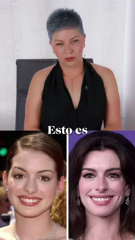 💁🏻‍♀️Que operaciones y tratamientos lleva Anne Hathaway⁉️ #operaciones #tratamientos #estetica 