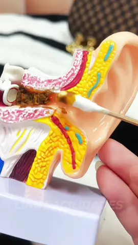 NÃO USE MAIS CONTONETES !! . . #limpezadeouvido #tiktokshop 