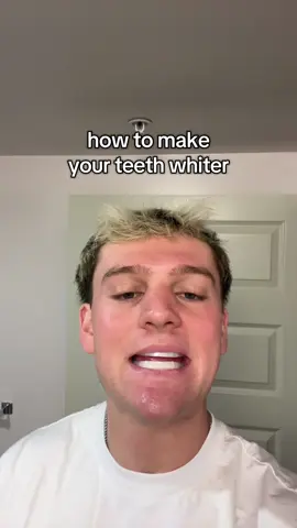 #teeth #whiteteeth #tips #fyp #viral 