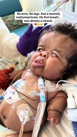 🤢😭💔 #baby #mother #son #labor #hospital #babyboy #mom #pregnant