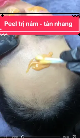 Peel trị nám - tàn nhang#túdoli #daotaohocvienchuyennghiep #xuhuong #thamnach #peeldadanang #daotaohocvien 