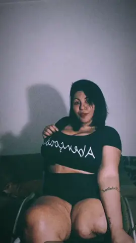 #black #carioca #plus #size #amputee #fyp #you #superação  🩼🦵👑