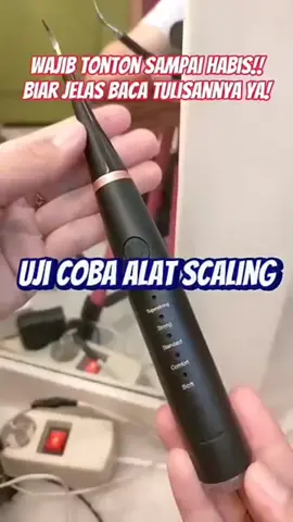 ZHYO Smart elektric Auto senyum pede! Gigi bersih tiap hari ✨ Cek link di keranjang kuning ya 🛒👇