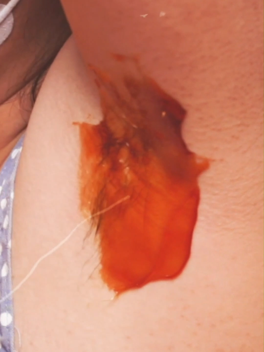 Mau waxing lebih tahan lama  #prev 09 an25104