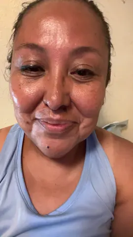 #nomakeup #freshface #sunburn 😄 was this an over share ?? 😛