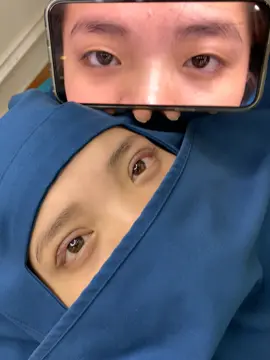 Nhấn mí đẹp tại Bắc Ninh #bacninh #xuhuongtiktok #lamdep #hanoi #nhanmi #suami 