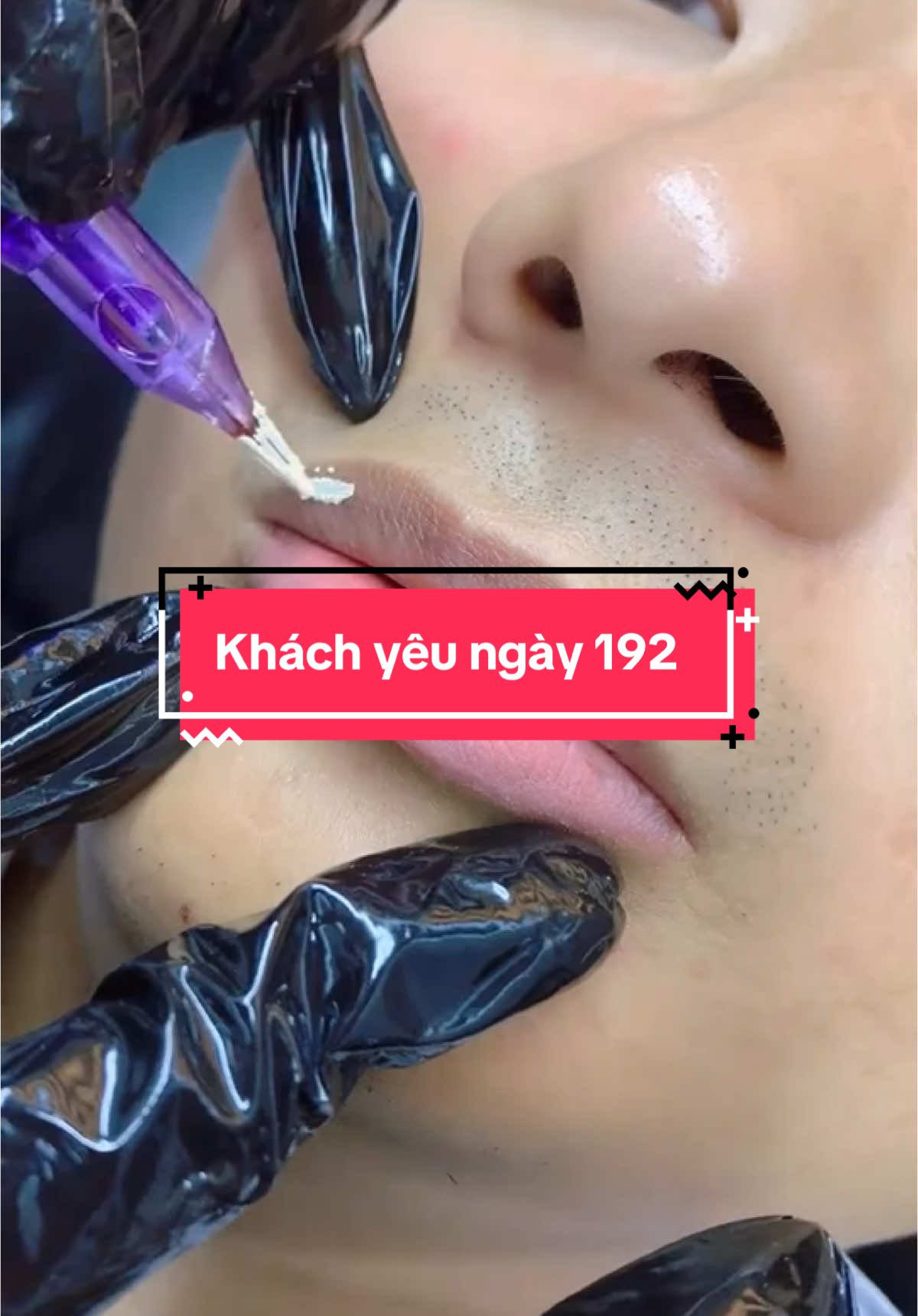 Khử thâm môi nam. Sỉn màu do hút thuốc, bẩm sinh ... chỉ hơn tiếng. Màu bền đẹp tự nhiên #khuthammoi #phunmoidep #lamdep #moihongtuynhien #kimbeauty 