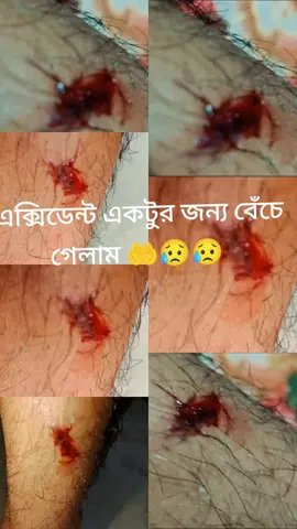#বাইক এক্সিডেন্ট একটুর জন্য বেঁচে  গেলাম আজ 🤲😥💔