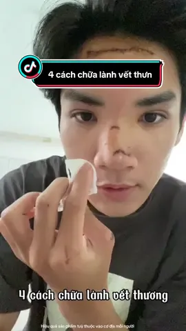 4 cách chữa lành vết thương #moseotainha #kemmoseo #triseo #actiscar 