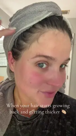 Divi Scalp serum for thinning hair 