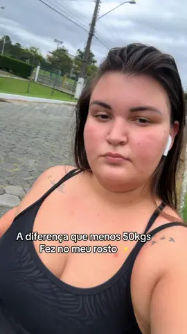 🥹✨ #emagrecimento #trendingvideo #antesydespues #antesedepois #bariatrica #bariatricsurgery #for #vaiprofycaramba 