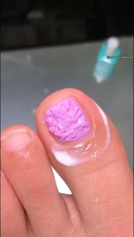 I used to dread gel removal，now it’s literally part of my self-care. #NailArt #nailremoverkit #nailremoval #morovangelpolishremover #nailstutorial #gelnails #foryou #NailProducts #nailtech  #fypnails 