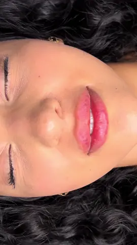 #lipfiller #filler #fillers💉 #dermalfiller #lipfiller #biglips #lipfillerchallenge #lipfillertraining #fyp #fyppp 
