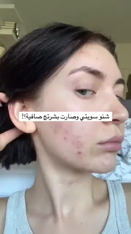 Dr. Althea 345 Relief Cream 50ml كريم دكتور الثيا 345 هو كريم جل مجدد غني بالموادالمغذية التي تجمع بمهارة بين المكونات لمعالجة للعيوب وتغذية البشرة وتوفير رعاية مهدئة، مما يؤدي إلى حل شامل للعناية بالبشرة...  يعنـي كريم يعالج كل مشاكل البشرة  الحبوب التهيج التصبغات الأثار 🏆✅ كريم 345 للإصلاح المكثف وترطيب البشرة من دكتور الثيا - 50مل المكونات الرئيسية: ✅ مستخلص نبات الصبار (Opuntia Ficus Indica Stem Extract): معروف بخصائصه المرطبة والمهدئة للبشرة، حيث يساعد في الحفاظ على الترطيب وتهدئة التهيجات. ✅ البانثينول ونياسيناميد: يساهمان في تحسين مرونة البشرة وتوحيد لونها، مع تعزيز مظهر صحي ومشرق. ✅ مستخلص أوراق سنتيلا اسياتيكا (Centella Asiatica ): يحتوي على خصائص مضادة للالتهابات تساعد في تهدئة البشرة الملتهبة أو المتهيجة. _ ازالـة الحبوب واثارها بشكل نهائي 😍 _ ترطيب عميق للبشرة. _ تهدئة البشرة المتهيجة. _ توحيد لون البشرة وتقليل التصبغات. _ تعزيز مرونة البشرة. _طريقة الاستخدام يومياً صباحاً ومساءً المنشأ / كوريا 🇰🇷 #توصيل_جميع_محافظات_العراق🌎🚖 #viral #fyp 