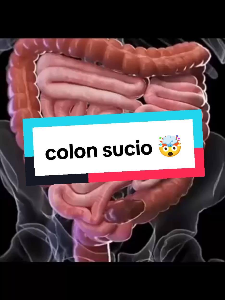 Escríbeme para mayor información 👉 #colon #colonirritable #intestino #intestinal #intestinalhealth #polipos #gases #dolor #colonoscopy #eeuu #losangeles #salud #healthy 