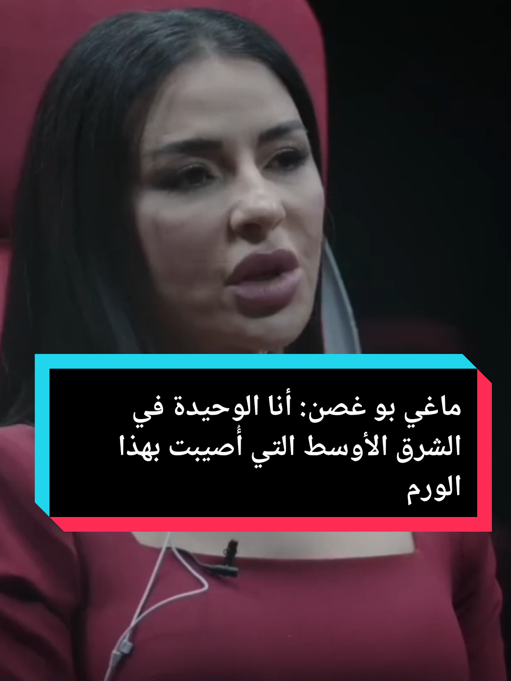 ماغي بو غصن: أنا الوحيدة في الشرق الأوسط التي أُصيبت بهذا الورم #ماغي_بو_غصن #ورم #مرض #عملية_جراحية #أورام 