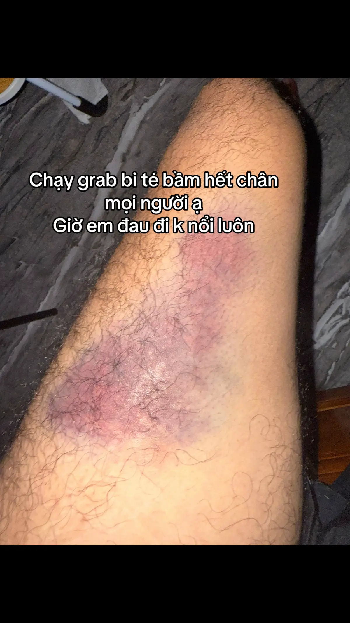 Mọi người ủng hộ cũng như giúp đỡ em nhé #xhtiktok #suythan #suythangiaidoancuoi #xh 