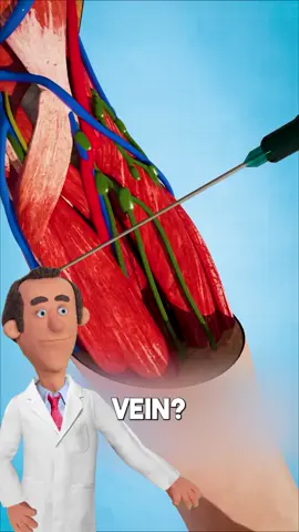 What is a blown vein? follow Dr. Pickle for MORE ‼️ #doctor #health