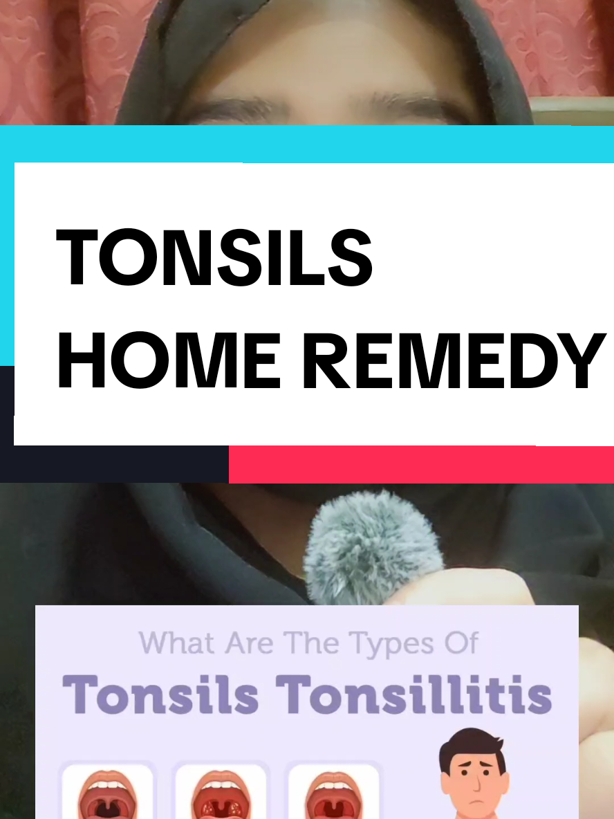 #tonsilstones #tonsils #tonsilitis 