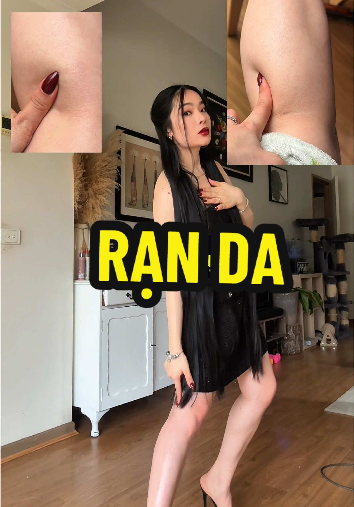 Cách Happi cải thiện rạn da @Happi Hair @Happi Pham #happipham 