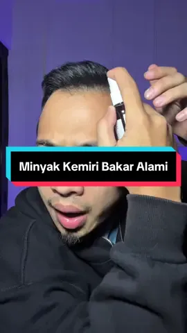 Serum Rambut Minyak Kemiri Bakar Asli Alami untuk menyuburkan rambut,Solusi ampuh untuk masalah kebotakan,uban,kulit kepala dll. #serumrambut #minyakkemiri #minyakkemiribakar #minyakkemiriasli 