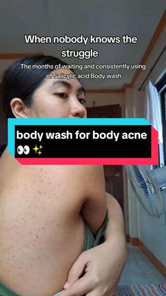 no buzzer, real bikin hilangin jerawat, cobain deh mumpung murah 😘👀 #jerawatpunggung #jerawat #bodywash #bodycare #sabun #fyp #fypシ #fypシ゚viral 