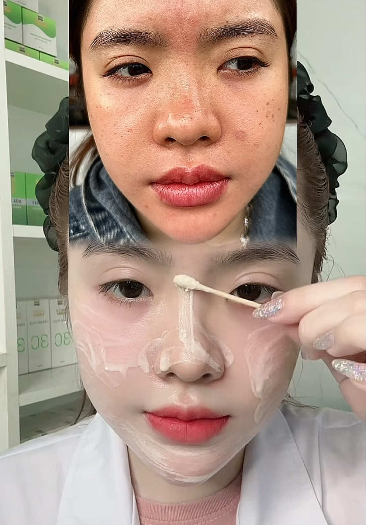 Sài đi rồi mê nha mấy bà. Tinh chất PEEL HÚT SẮC TỐ NÁM SẠCH MỤN TRẮNG DA #yodyphuonganh 