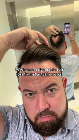 #hairloss #hairpowder #men #hair #alopecia #fyp #thinninghair #confidence #hairtransformation #tiktokshop 