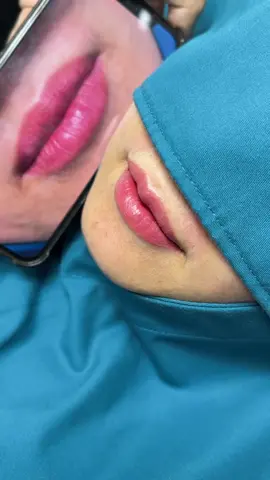 Cắt tạo hình môi vĩnh viễn #catmoi #bacninh #xuhuongtiktok #lamdep #hanoi 