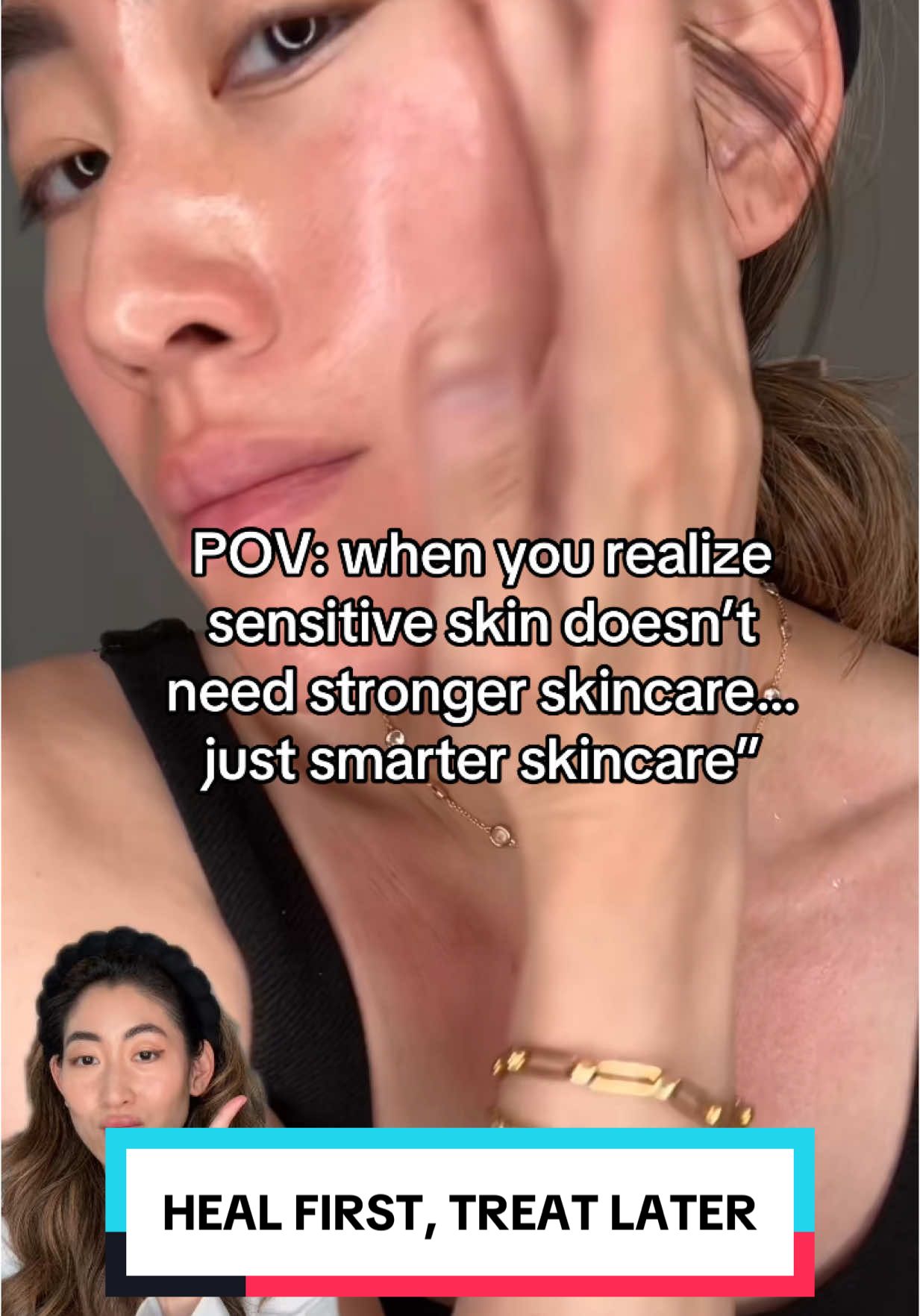 Sensitive skin doesn’t need stronger skincare-just smarter skincare 💡 When my skin is freaking out, I hit reset with the gentlest cream I own: SoonJung 2x Barrier Cream. No fragrance. No fluff. Just barrier-loving ingredients like panthenol + madecassoside 🙏 🛒 It’s on major sale for Prime Day right now—run, don’t walk 🏃‍♀️💨#soonjungpartner #soonjung #etude #sensitiveskin #moisturizer #primeday #barrierrepair #skincaretok #kbeauty 