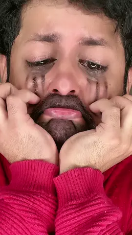 I don't have any friends,😩😫 am I ugly?😭💔 #fyp #fypp #juggedit #jugg #blowthisup #xyzbca #cute #рек #большиеглаза #trending #passion #tiktok #foryoupage #foryou #viral #Love #broken #sad #bad #3danimation #anime #cutebaby #copylink #ugly #sybau #cringe #fakelove 