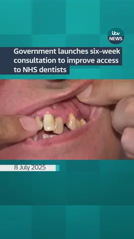 The Department for Health and Social Care (DHSC) launched a major consultation to expand care provisions in NHS dentistry. The consultation will last for six weeks, closing on Tuesday 19th August.  #itvnews #news #dentists #nhs