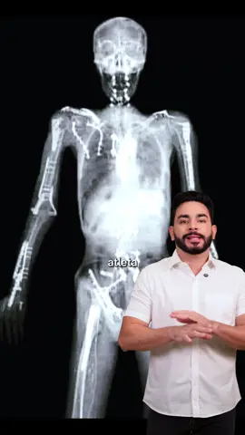 #travispastrana #motocross #freestyle #radical #moto #record #inss #auxilioacidentedetrabalho #acidente #beneficio #recorde #sequela #lesao #auxilioacidente 