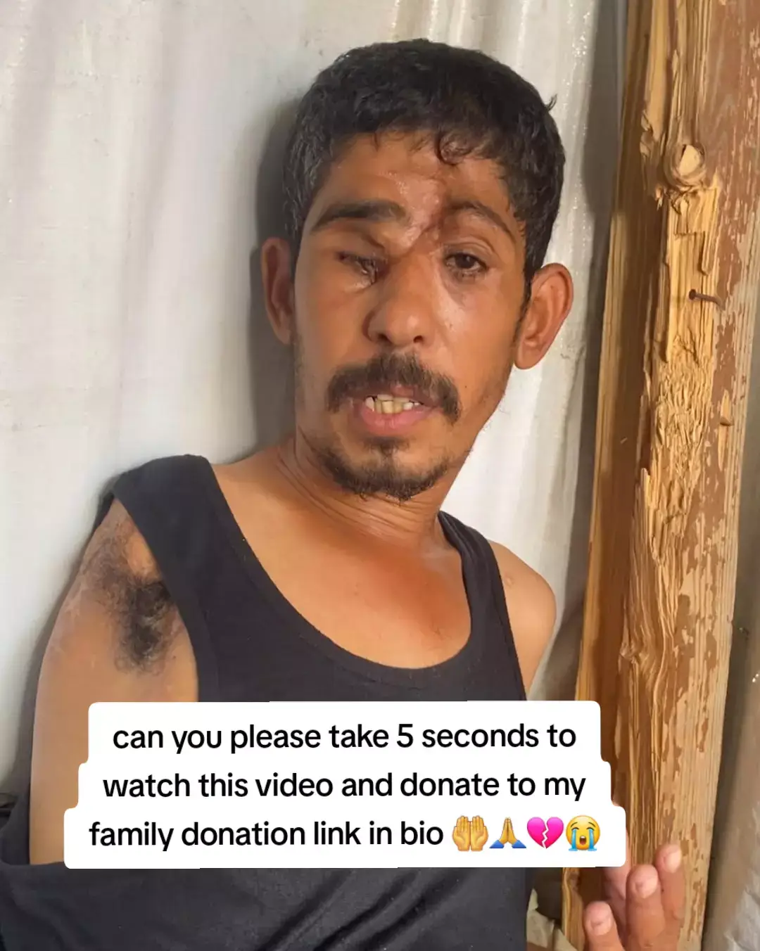 ‏Hilal deserves to be in a place with health care, O world, where is humanity? ‏ Why is all this pain, this is inhumane, people of humanity, Hilal's pain is great as he lives in this helpless tent that cannot describe what happens to him because of the difficulty of the matter, how can we affect him and help him with this fatigue, and indeed we will explain this by providing our contribution and assistance to this family that looks at us with a look of survival. The support link is available in the bio.💔😔🔗 هلال يستحق أن يكون في مكان فيه رعاية صحية، يا عالم أين الإنسانية يا عالم؟  لماذا كل هذا الألم، هذا غير إنساني يا أهل الإنسانية، ألم هلال كبير وهو يعيش في هذه الخيمة التي لا حول له ولا قوة ولا يستطيع وصف ما يحدث له لصعوبة الأمر، كيف لنا أن نؤثر عليه ونساعده بهذا التعب، وبالفعل سنوضح ذلك بتقديم مساهمتنا ومساعدتنا لهذه العائلة التي تنظر إلينا بنظرة النجاة. رابط الدعم متاح في السيرة الذاتية.💔🔗 #followers  #follow  #fuy  #save 
