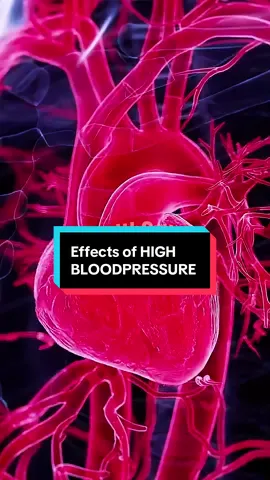 Effects of HIGH BLOODPRESSURE  #highbloodpressure #bloodpressure #hypertension #creatorsearchinsights 