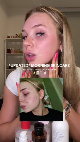 It's been a hot second but here's my *UPDATED* morning skincare routine for my sensitive acne prone skin!   #morningskincare #affordableskincare #skincareroutine #neogen @NEOGEN GLOBAL 