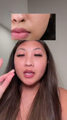 This has helped my cracked skin so much  #jiyutonerpads #jiyu #beautysecrets #beautyhacks #redness #koreanskincare #hyperpigmentation #skincaretips #acnescar #darkspot #dealsforyoudays 