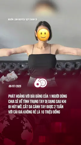 CHÚNG TA NÊN HẾT SỨC CẨN THẬN VÀ CẦN CÓ PHƯƠNG PHÁP CẢI THIỆN VÓC DÁNG HỢP LÝ ĐỂ TRÁNH TIỀN MẤT TẬT MANG =(( #tiktoknews #60giay #theanh28