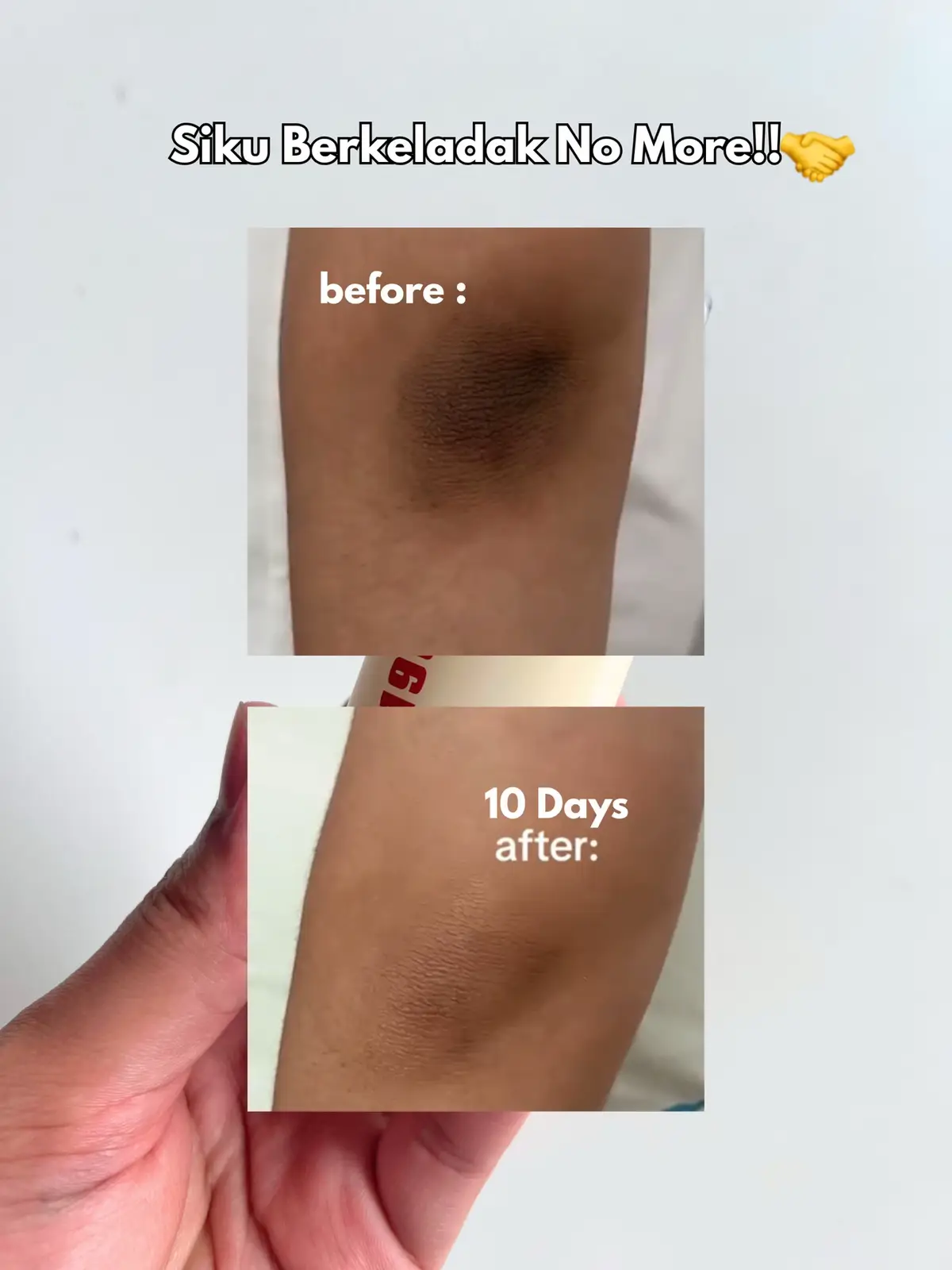 This is it!! Sapu dekat siku, ketiak & lutut sekali 🤝 #retinol #retinal #darkspots #ksecret