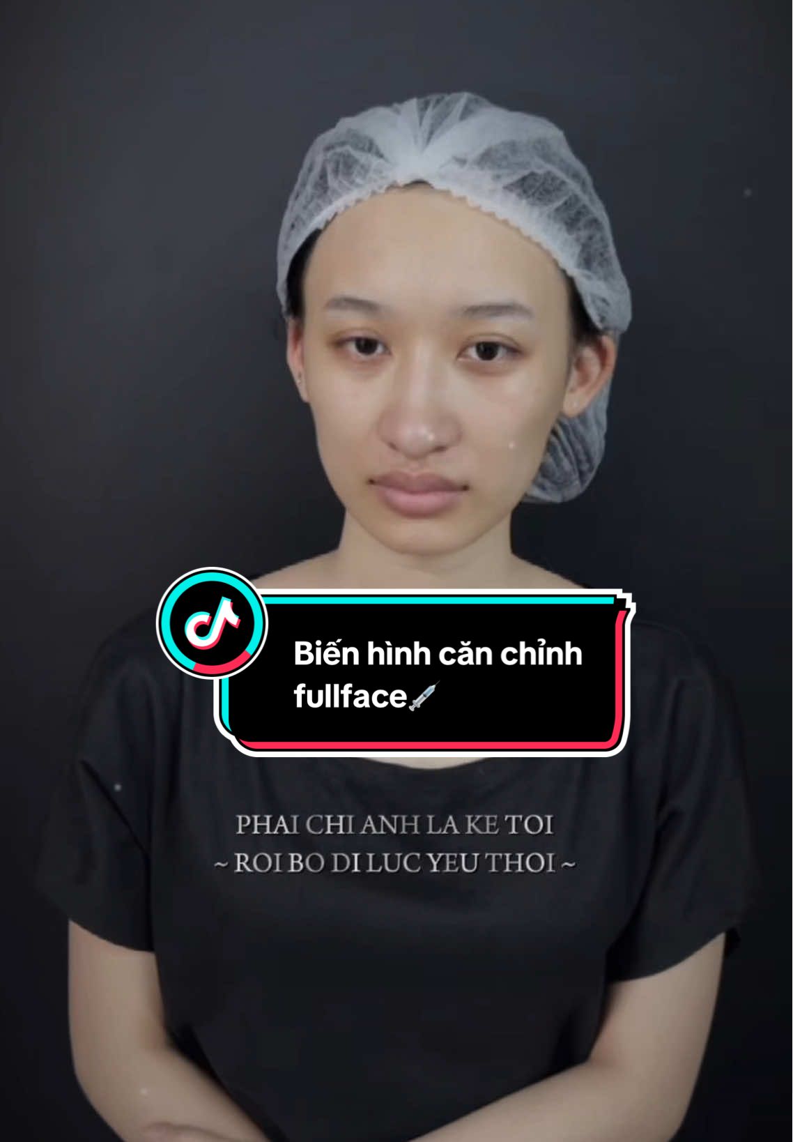 Thay đầu cho em gái🥰🥰💉#botox #tiêmfiler #combofullface #xuhuong #fyp #hot #bienhinh #thaydoi 