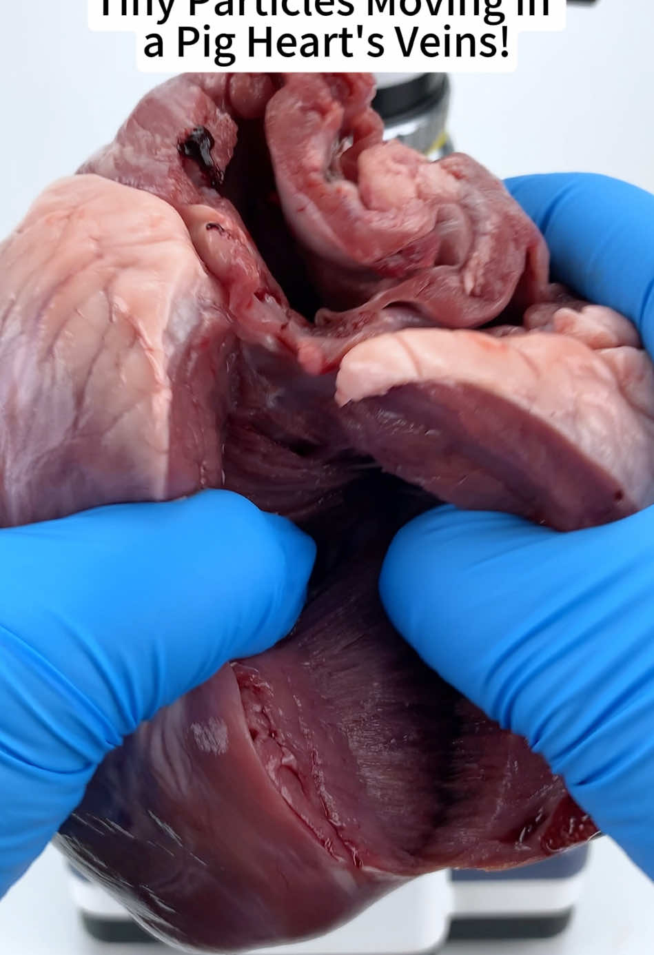 Zoomed In: The Disturbing Tiny Particles in a Pig Heart's Veins!  #capcutforus #capcut #microscope #capcutpioneer #usa_tiktok #foryoupage 